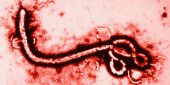 هيئة صحية أمريكية تحذر من الاتصال الجنسي مع الناجين من الإيبولا