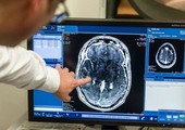 العلماء يخترقون حاجز المخ لعلاج المرضى