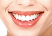 طبيب أسنان: احذروا ابتسامة هوليوود!