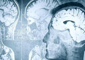 العلماء يؤكدون وجود صلة بين اضطرابات النوم والذاكرة