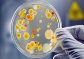 أميركا ترصد أول حالة بكتيريا مقاومة لكل أنواع المضادات الحيوية