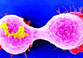 التحليل الجيني يكشف عن 11 نوعاً لسرطان الدم