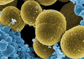 ظهور بكتيريا في أميركا تقاوم المضادات الحيوية
