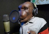 بالصور: صاحب أغرب رأس في أوغندا يتحول لنجم غنائي