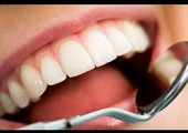 كيف تحافظ على أسنانك عند الإصابة؟